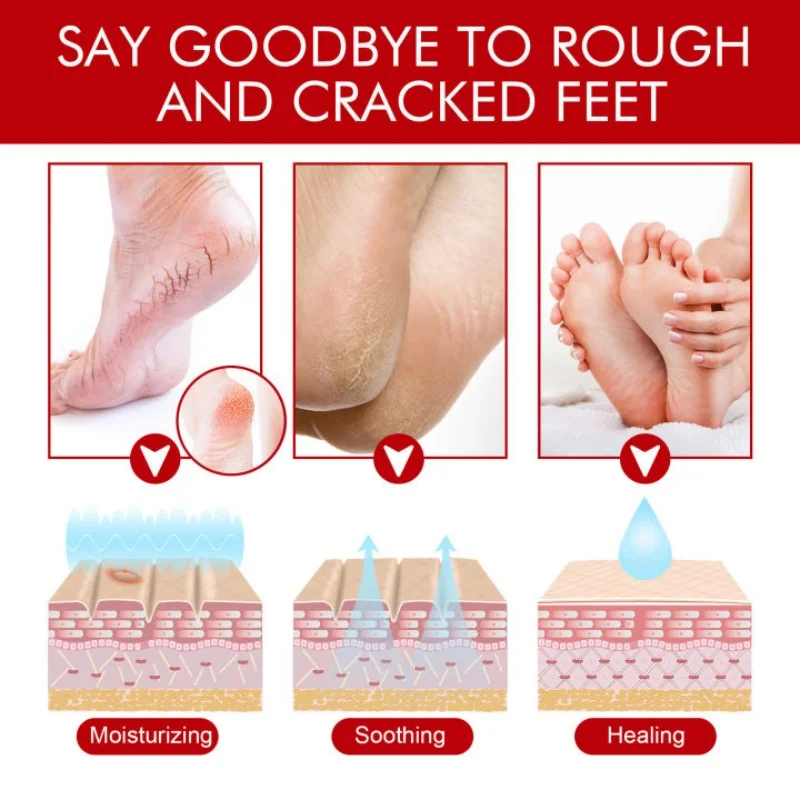 Anti Crack Foot Cream Heel Cracked Repair Horse Oil Cream Smooth Removal Dead Skin Callus Anti-Drying Hand Feet Skin Care 30g