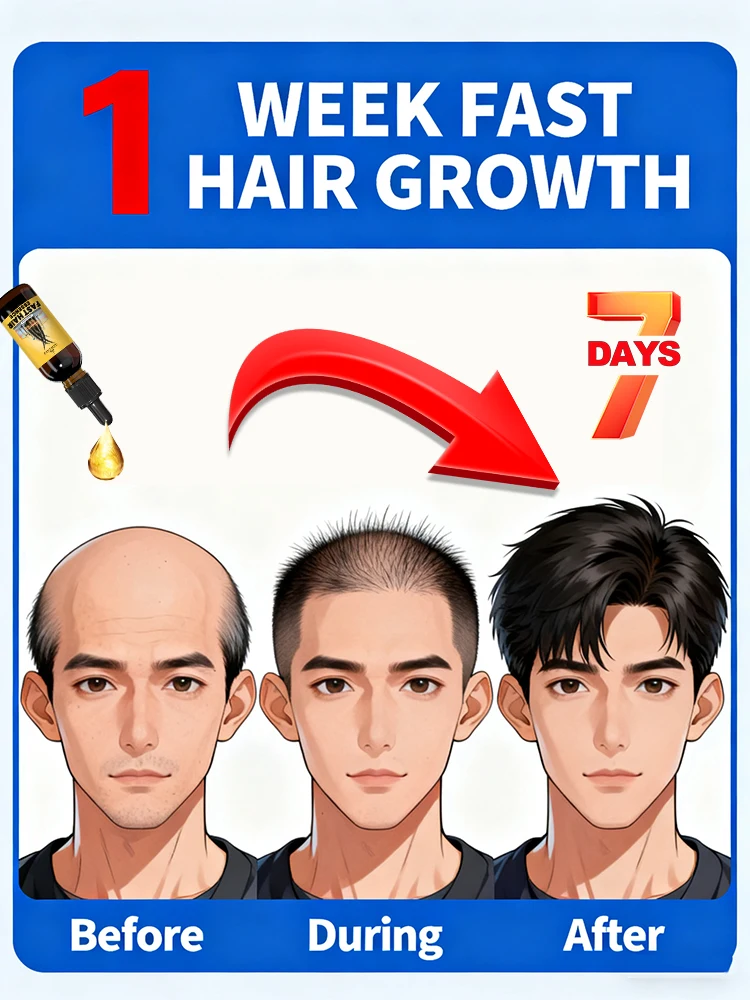 ¿Quiero decir adiós a la caída del cabello? Nuestros productos pueden penetrar profundamente en los folículos capilares y ayudar a la regeneración del cabello.