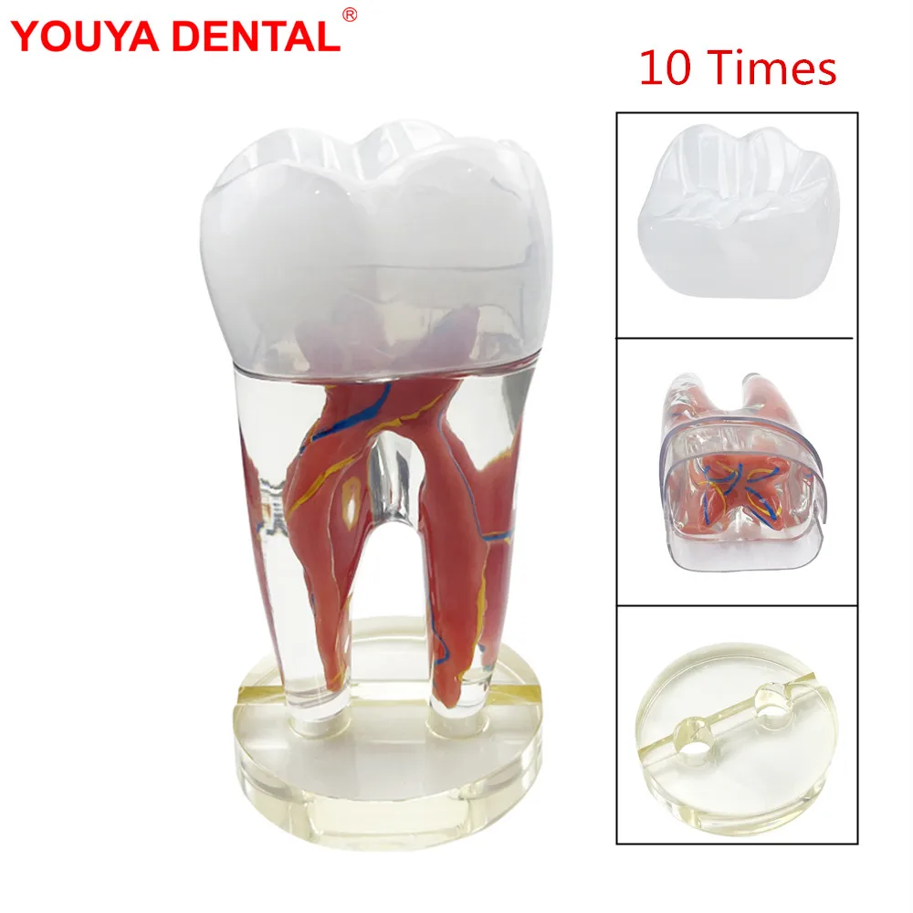 10 Times Endodontic Dental Model Large Clear Tooth Pulp And Nerve Teeth Model Detachable Models For Teaching Studying Education