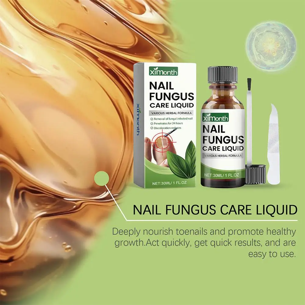 Óleo De Tratamento De Fungo Do Pé, Nail Repair Gel, Melhor Essência De Infecção, Nail Repair, Essenice Oil, R8D2