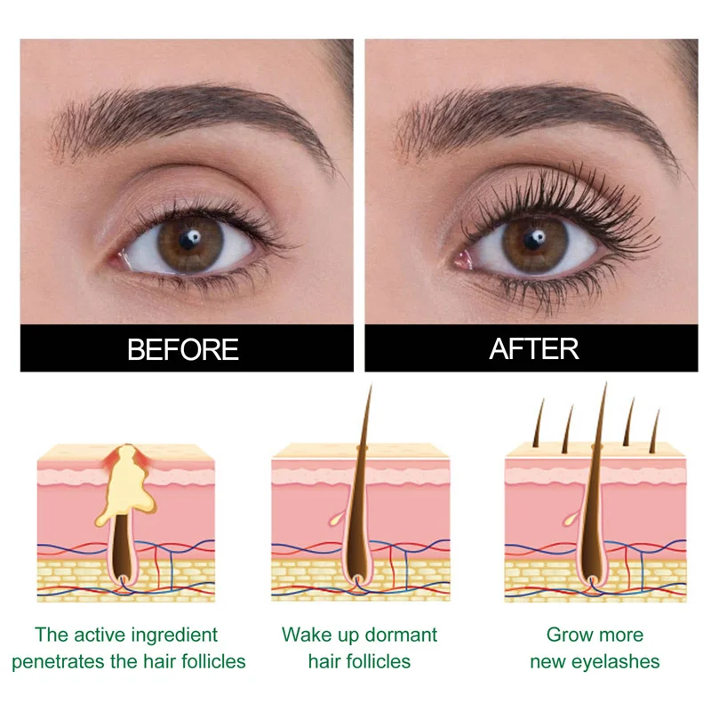 Snelle Wimpergroei Serum 7 Dagen Natuurlijke Wimperversterker Langer Voller Dikkere Curling Lash Behandeling Oogzorg Koreaanse Make-up