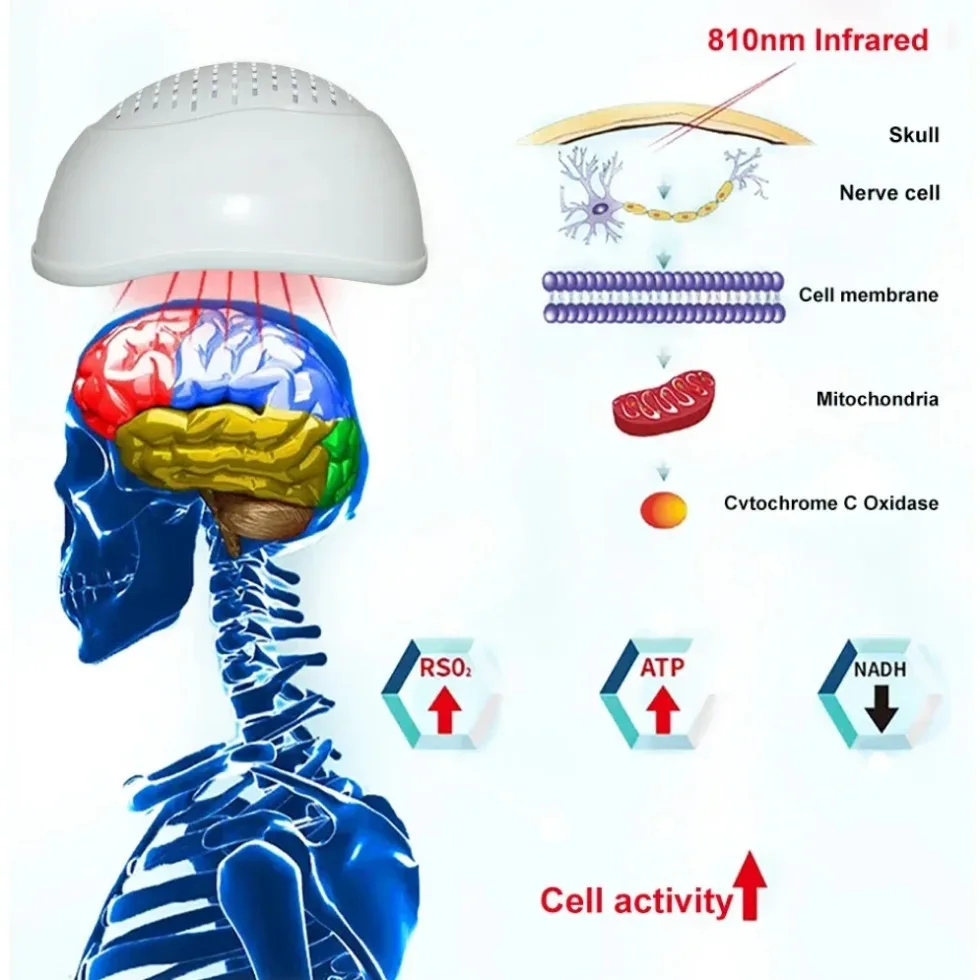 Zjkc Leidde Hersengolfhelm Migraine Hoofdpijn Verlichting Fotobiomodulatie 810nm Lichttherapie Parkinson Autisme Depressie Angst