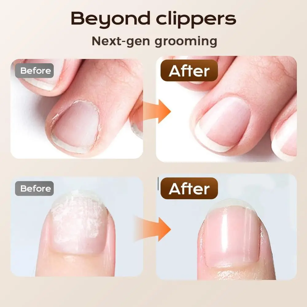 

2 Speeds Adjustable Electric Polishing Nail Clippers Quiet Dual-Speed Electric Toenail Clippers One-Hand Operated Rechargeable