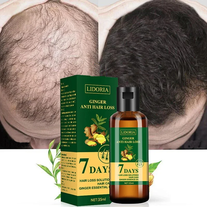 Ginger Hair Growth Essential Oil Natural Anti Hair Loss Products Fast Grow Prevent Baldness Treatment Germinal Liquid Men Women