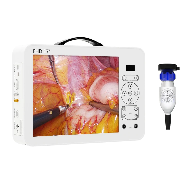 portable endoscopy machine with recording device 1080p full hd equipment for laparoscopy hysteroscopi ent machine surgery