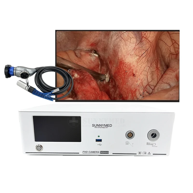 SY-PS048T urology anorectal equipment portable endoscopy camera endoscopy camera light source laparoscopy cystoscope