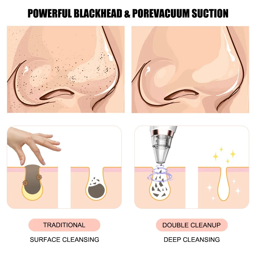 Removedor elétrico de cravo, aspirador de acne, remoção de manchas pretas, limpeza profunda facial, máquina de limpeza de poros, ferramentas de cuidados com a pele