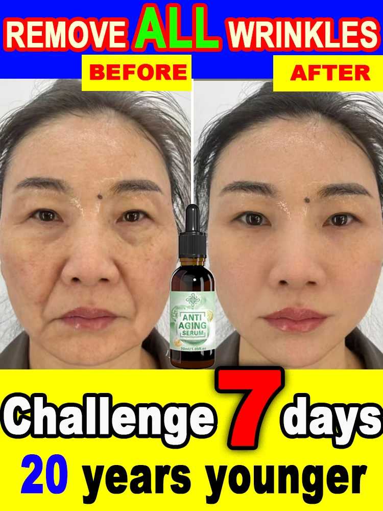 

Wrinkles disappear Become beautiful now