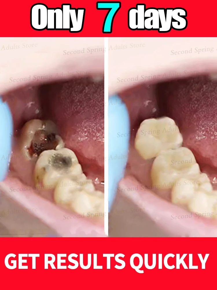 

Repair teeth, prevent tooth decay, and effectively remove dental plaque