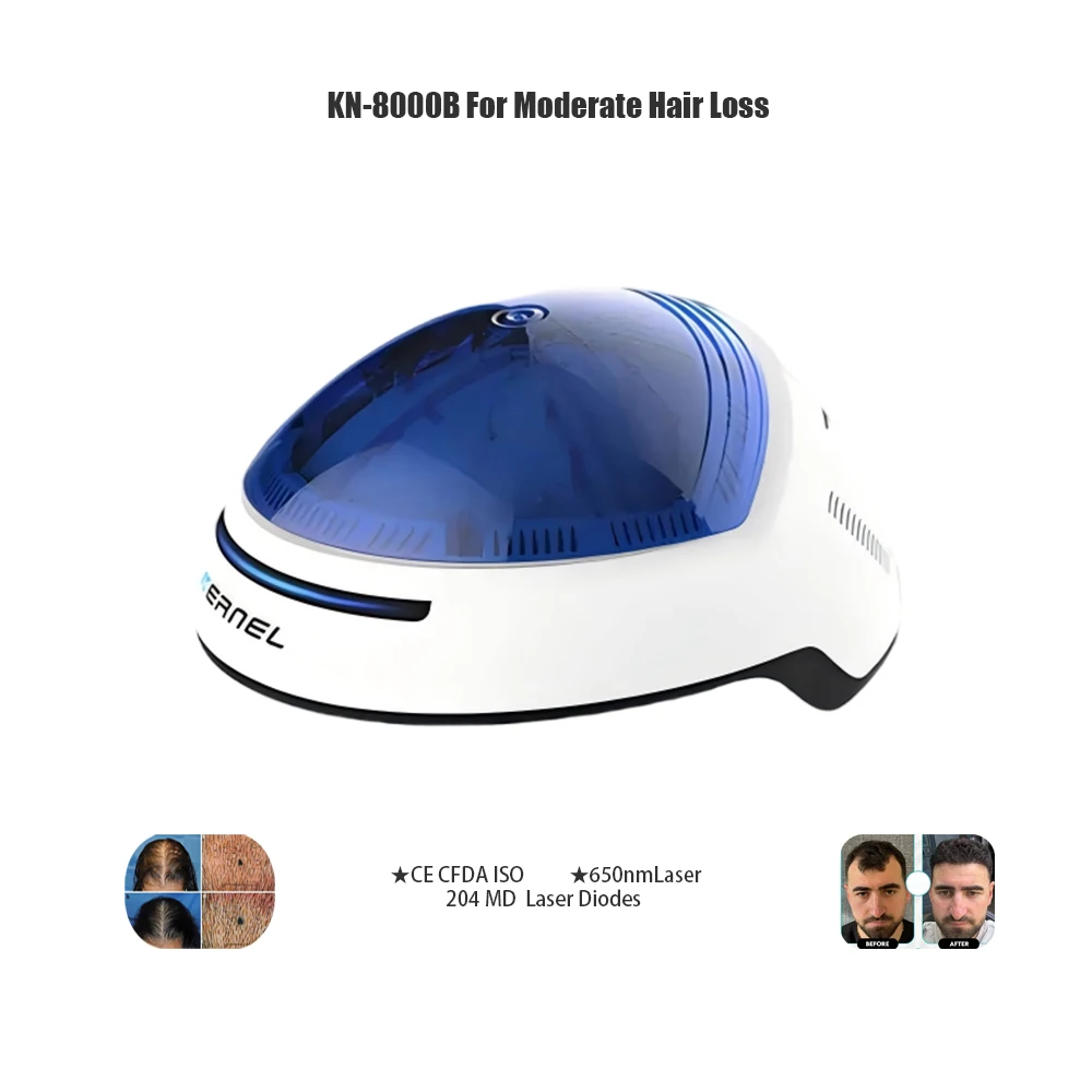 KN8000B  Therapy Cap for Androgenetic Alopecia 204 Red Light 650nm Diodes Hair Loss Treatment Device