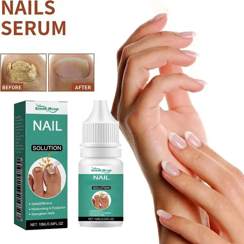 Óleo Essencial Herbáceo para Unhas, Unhas