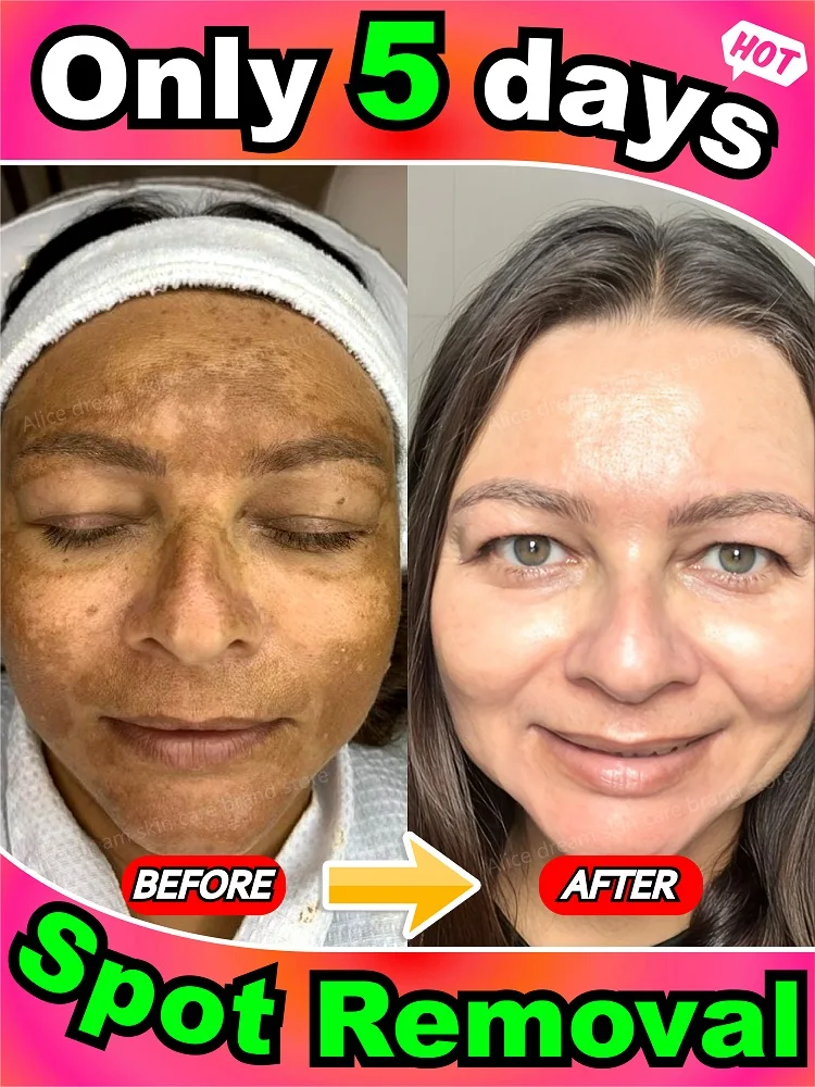 Effectively solves all pigmentation symptoms