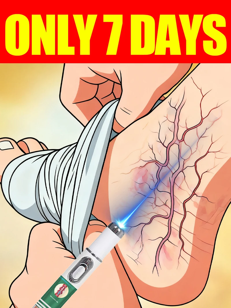 

Leg care tools Reduce Uncomfortable For Legs Improving Blood Circulation Varicose Veins Pen Skin Care Product