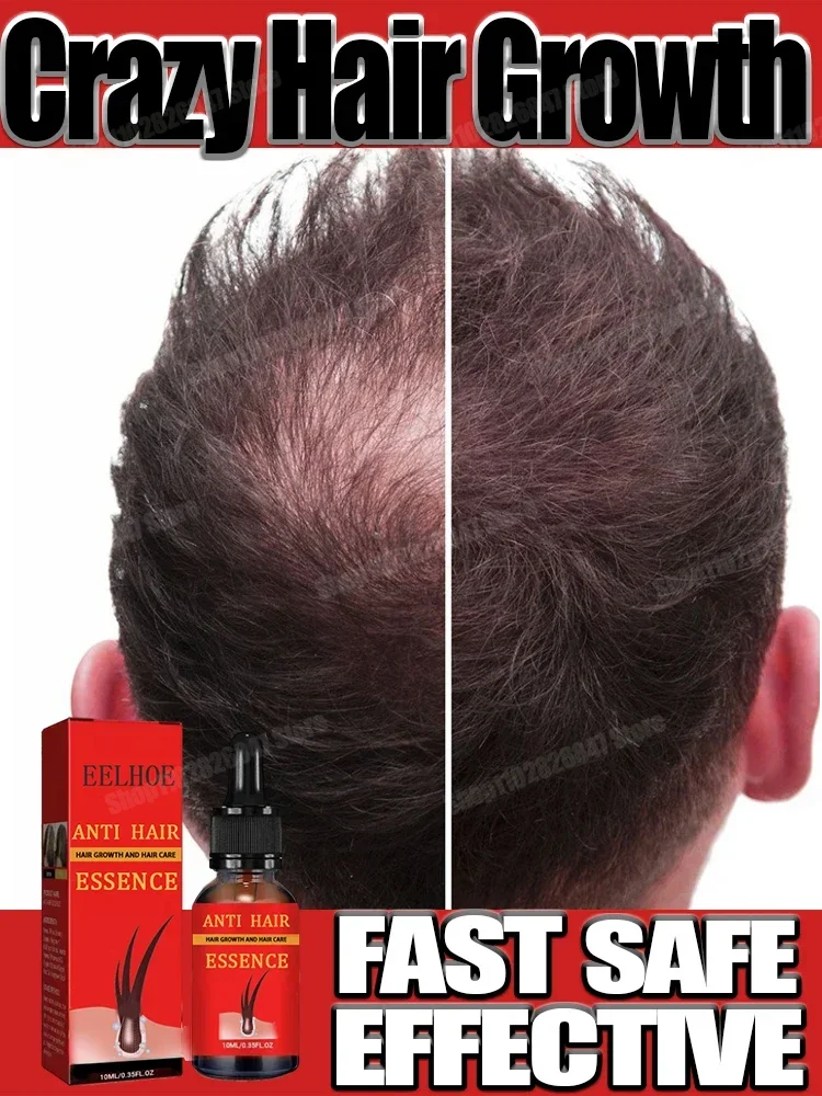 

Hair Growth Essential Loss Regrowth Treatment Strengthens Hair Nourishes Scalp Light Weight Non Greasy Improve Scalp Circulation