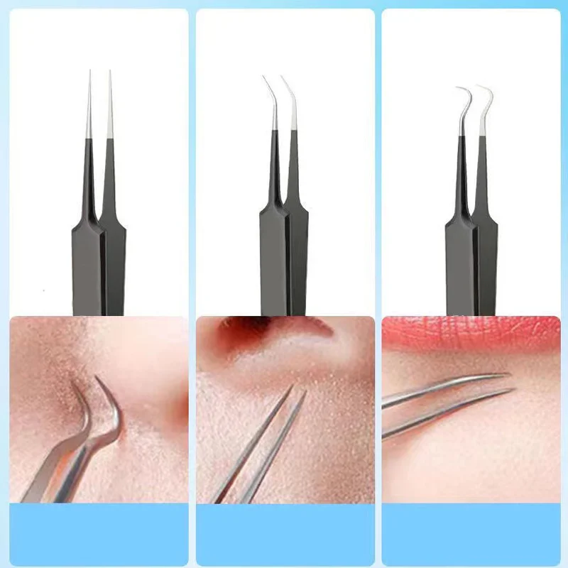 4/6PCS Gezicht Cleaning Kit Puistje Removal Tool Mee-eters Acne Remover Zwarte Stippen Remover Acne Tool Comedo Whitehead Popping Zit