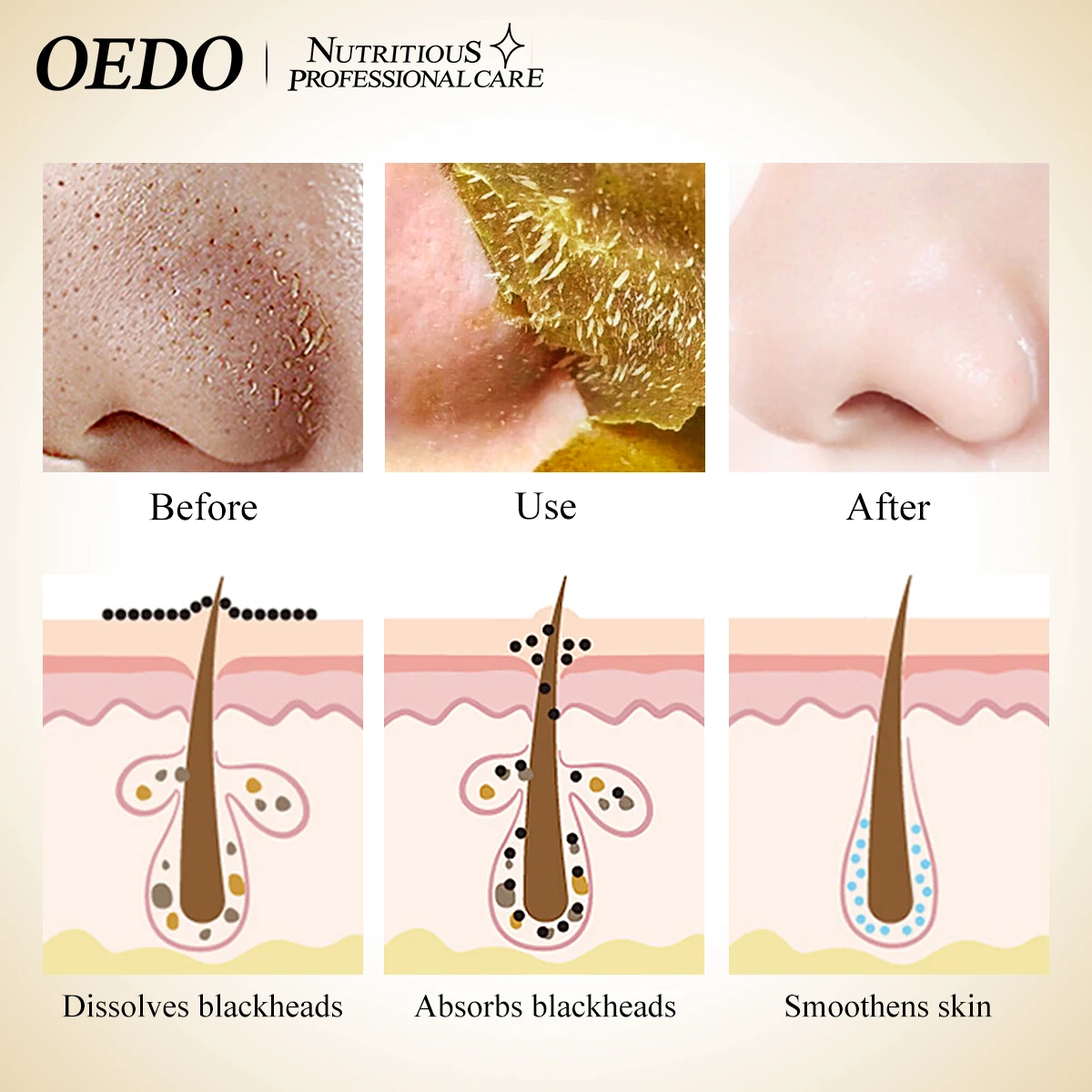 Oeodo-ブラックヘッドマスク,フェイシャルマスク,リングクリーム,厚手のスキン,にきび,クレンジングマスク,保湿クリーム