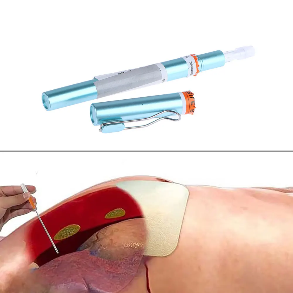 Emergency Equipment First Aid Kit Tension Pneumothorax Thoracic Needle Medical Chest Decompression Needle