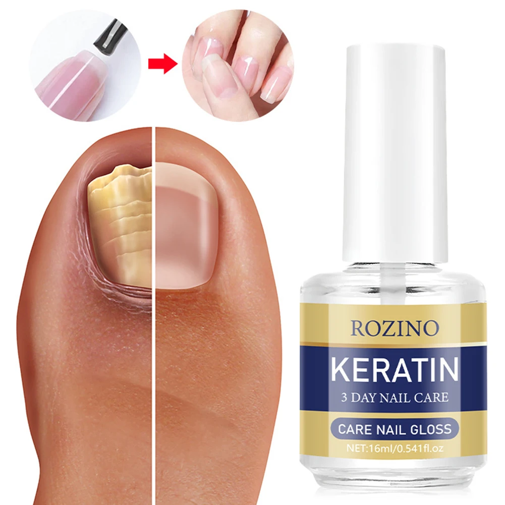 Keratins 3 Day Growth Nail Treatmens Strengthener Fix Renew Damage Fungals Toenail Serum For Finger Toe Nail