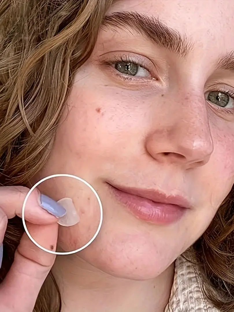 360 قطعة من رقع حب الشباب المستديرة بلون البشرة |   غرواني مائي وغطاء لطيف