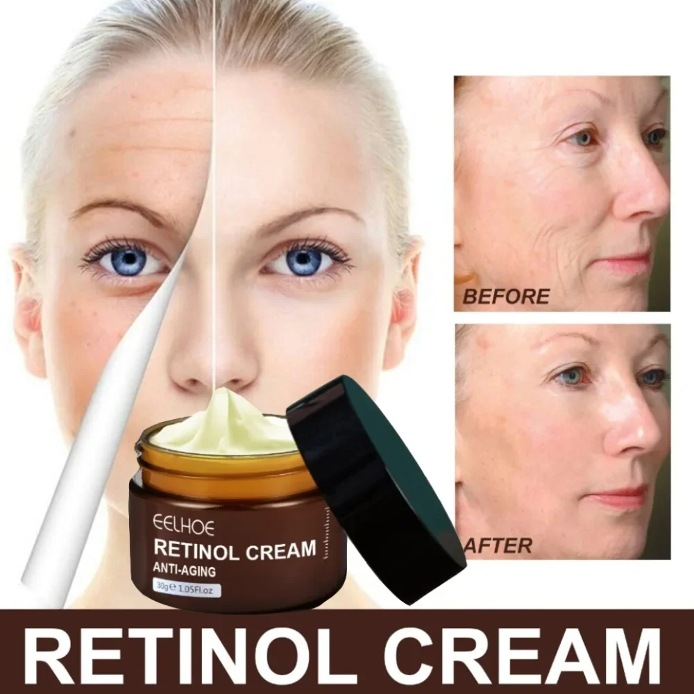 Retinol Wrinkle Removing Cream Anti Aging Firming Lifting Fade Fine Lines Moisturizing Brightening Skin Care Korean Cosmetics