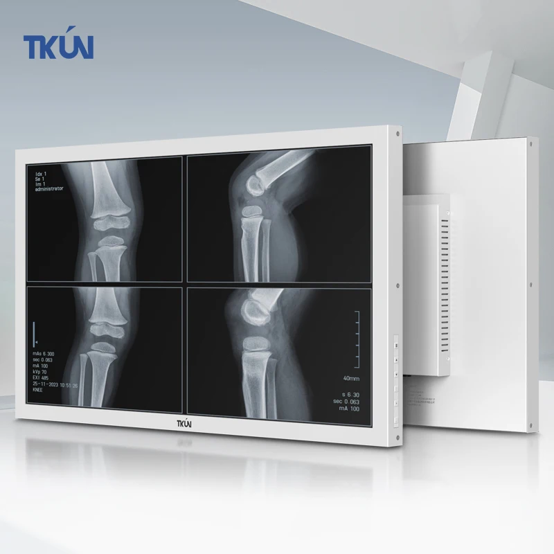 

SDI-3G 27-Inch Diagnostic Medical Display 8MP T270WQUGA-SDI HD2160 LED Screen With BNC Interface For Desktop Medical Office Use