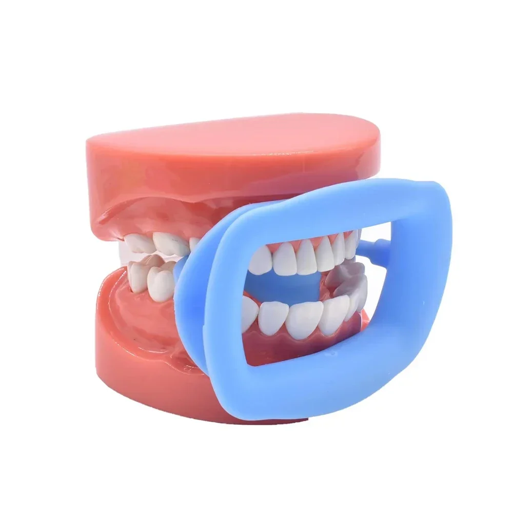 AG 1Pcs Dental Soft Silicon 3D Lip Cheek Retractor Mouth Opener Cheek Expand Dental Orthodontic Consumables 4 Colors Available