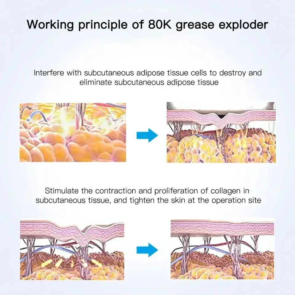 6 in 1 80K fit burner cavitation machine weight loss body slimming cavitation machine 80kPopular