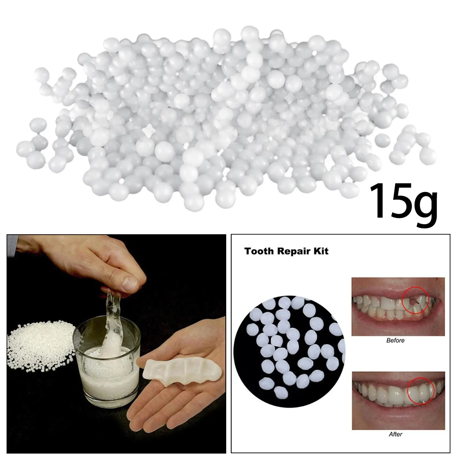 Temporary Tooth Repair Kit Moldable Fake Filling Fix The Missing and