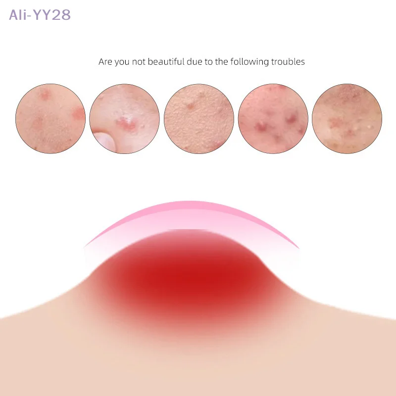 {YY28} 24/28/36 قطعة لون ستار فراشة القوس حب الشباب بقع غرواني مائي بثرة ملصق المخفي بقعة الوجه العناية بالبشرة ماكياج أداة #4