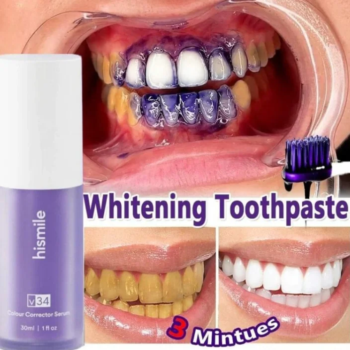 Teeth Whitening Cream - 30ml Hismile V34 Colour Corrector Serum