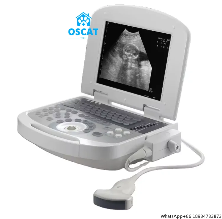 OSCAT Physical Therapy Ultrasound Scanner Therapeutic Ultrasound Machine Diagnosis Probe Laptop Ultrasound Scanner