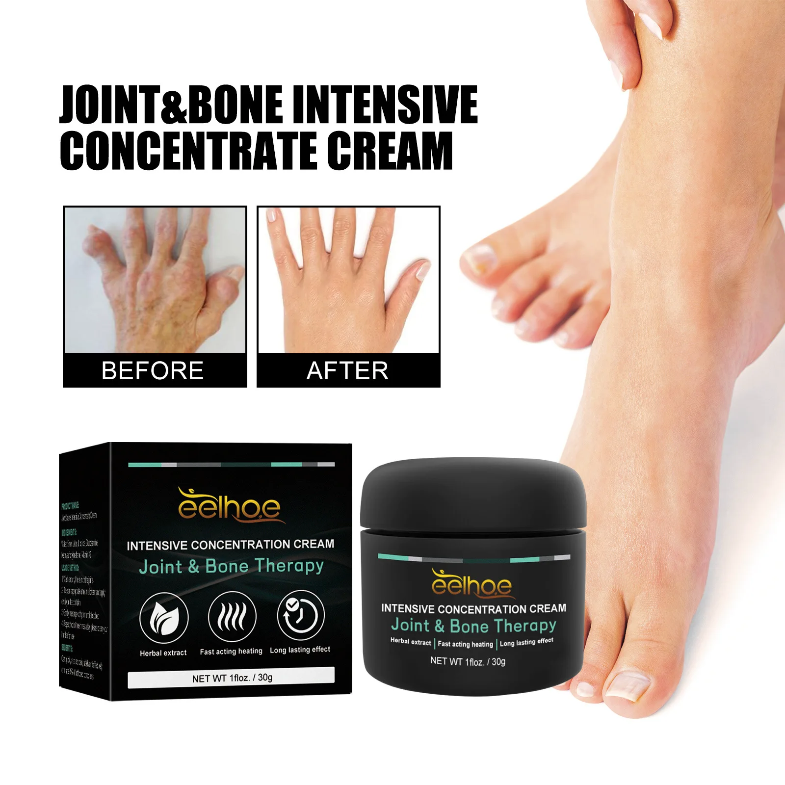 

30g Hallux valgus Nursing Correcting Cream For Joint And Bone Treat Joint Knee Toe Finger Bone Spur Discomfort Relief Cream Care