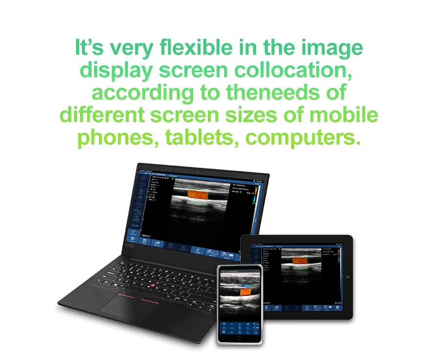 Wireless Portable Ultrasound Probe scanner WIFI Doppler wifi ultrasound scanner Machine support iOS Android Windows