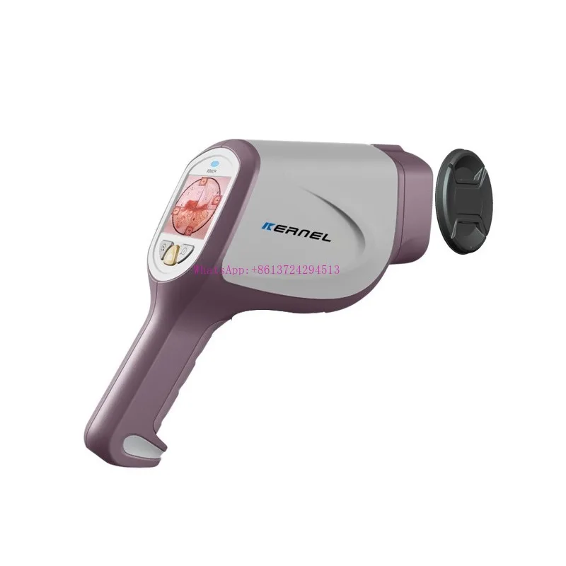 KN-2200I(H) High definition gynecology HD camera digital video colposcopy for vaginal disease examination