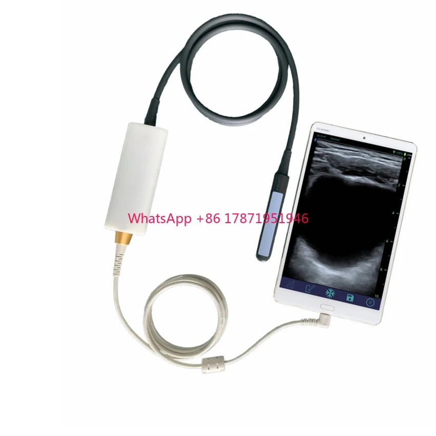 

USB Rectal Black and White Ultrasound Probe 64 Elements veterinary ultrasound machine for cattle use