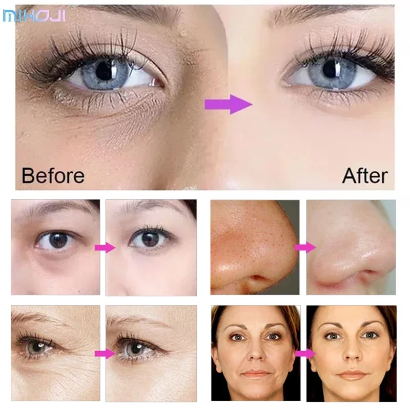 2026 Cryo Portable Cool & hot Electropration Skin Tightening  Rf Ems Skin Freezing Instrument D Cool Machine