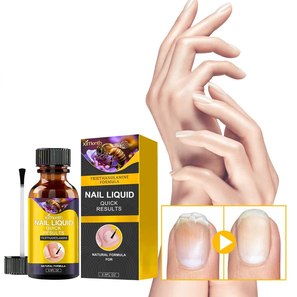 Esencia para el cuidado de las uñas, aceite de onicomicosis para las uñas de los pies y los dedos, repara daños y repara el suero