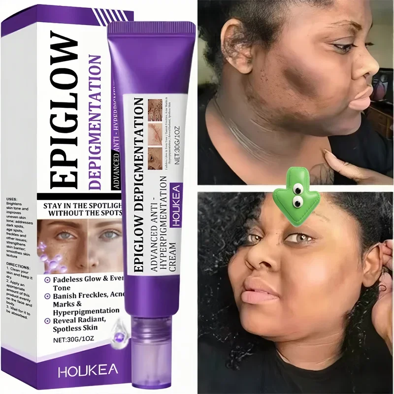 

Face Brightening Cream Niacinamide Reduce Chloasma Melasma Melanin Fade Fine Lines Lighten Dark Skin Serum Care Brighten Cream