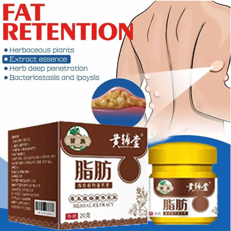 New Anti-Swelling Lipoma Removal Cream Lymphatic Drainage Detox Breast Lymph Nodes Subcutaneous Lumps