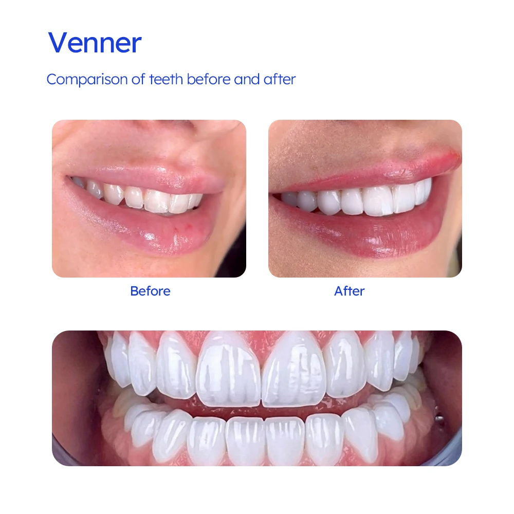 5 قطعة/صندوق الأسنان ليثيوم ديسيليكات C14 Sirona Cere نظام الزجاج السيراميك كتلة 18*15*13 مللي متر LT/HT/MT VITA 16 ألوان لشاري الجانب #6