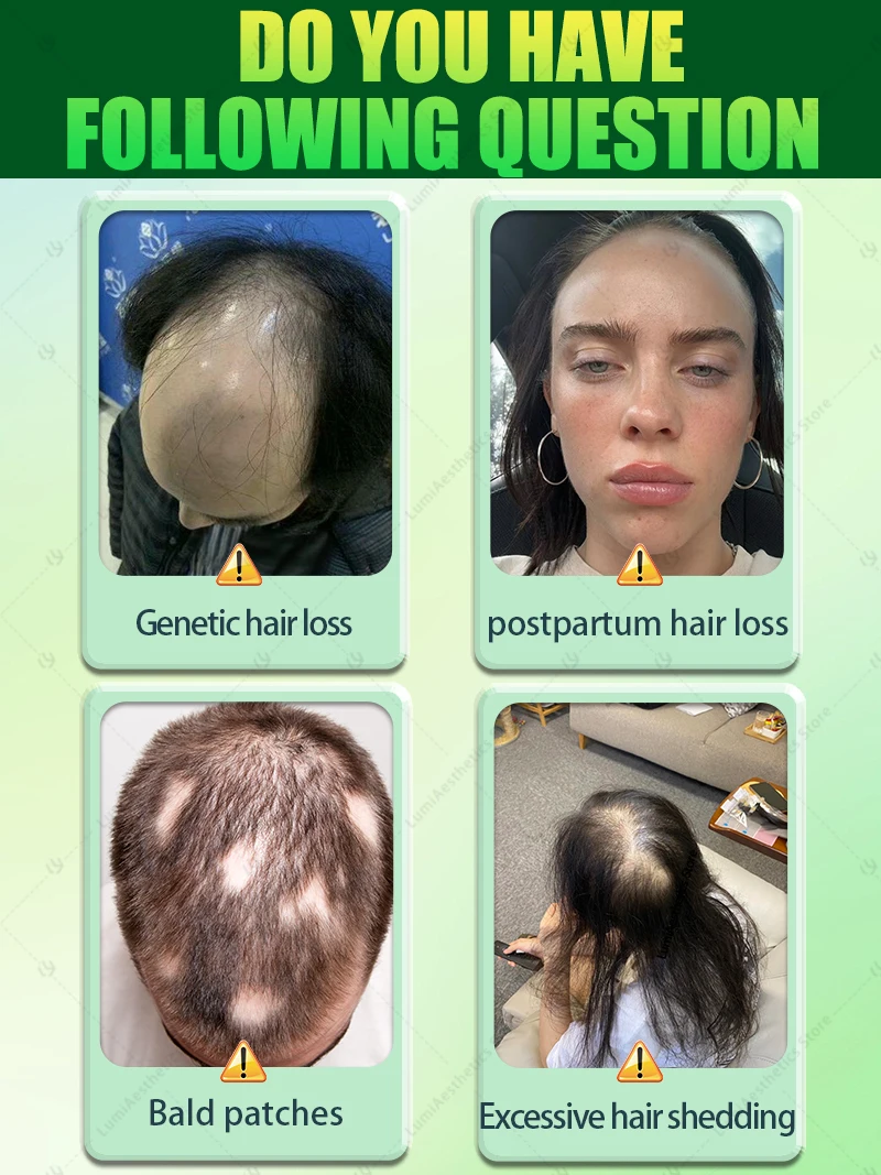 ᵀʰⁱⁿⁿⁱⁿᵍ ʰᵃⁱʳ ⁱˢ ⁿᵒ ˡᵒⁿᵍᵉʳ ᵃ ᵖʳᵒᵇˡᵉᵐ‧ ᶜʰᵒᵒˢᵉ ᵒᵘʳ ʰᵃⁱʳ ᵍʳᵒʷᵗʰ ᵖʳᵒᵈᵘᶜᵗˢ ᵗᵒ ᵐᵃᵏᵉ ʸᵒᵘʳ ʰᵃⁱʳ ᵗʰⁱᶜᵏᵉʳ ᵃⁿᵈ ˢᵗʳᵒⁿᵍᵉʳ‧