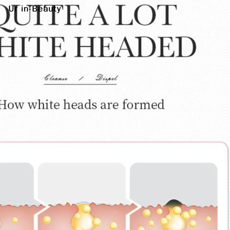 

Трехступенчатые пластыри BIOAOUA для удаления черных точек, увлажняющие, очищающие поры и сужающие мелкие поры, 7 г x 3 шт.