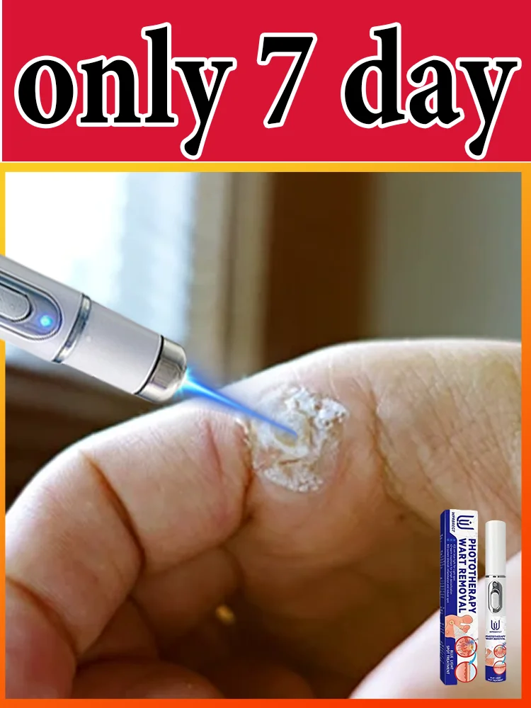 

Gᴇɴᴇʀᴀᴛɪᴏɴ-3 Lᴀsᴇʀ Sᴀʏs Gᴏᴏᴅʙʏᴇ Tᴏ Wᴀʀᴛs Iɴ 7 Dᴀʏs