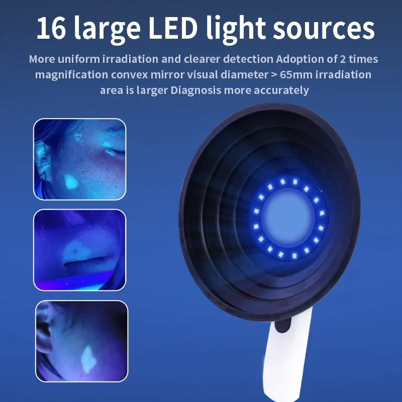 우드 램프 피부 분석기 피부 UV 확대기 백반증 탐지 램프 우드 램프 라이트 피부 분석 탐지 피부 관리