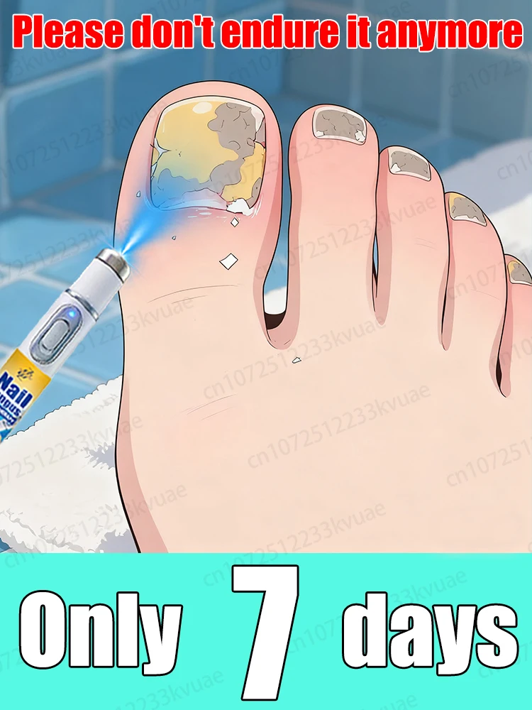 

2026 Новое обновление синего лазера для решения бородавок для мужчин и женщин