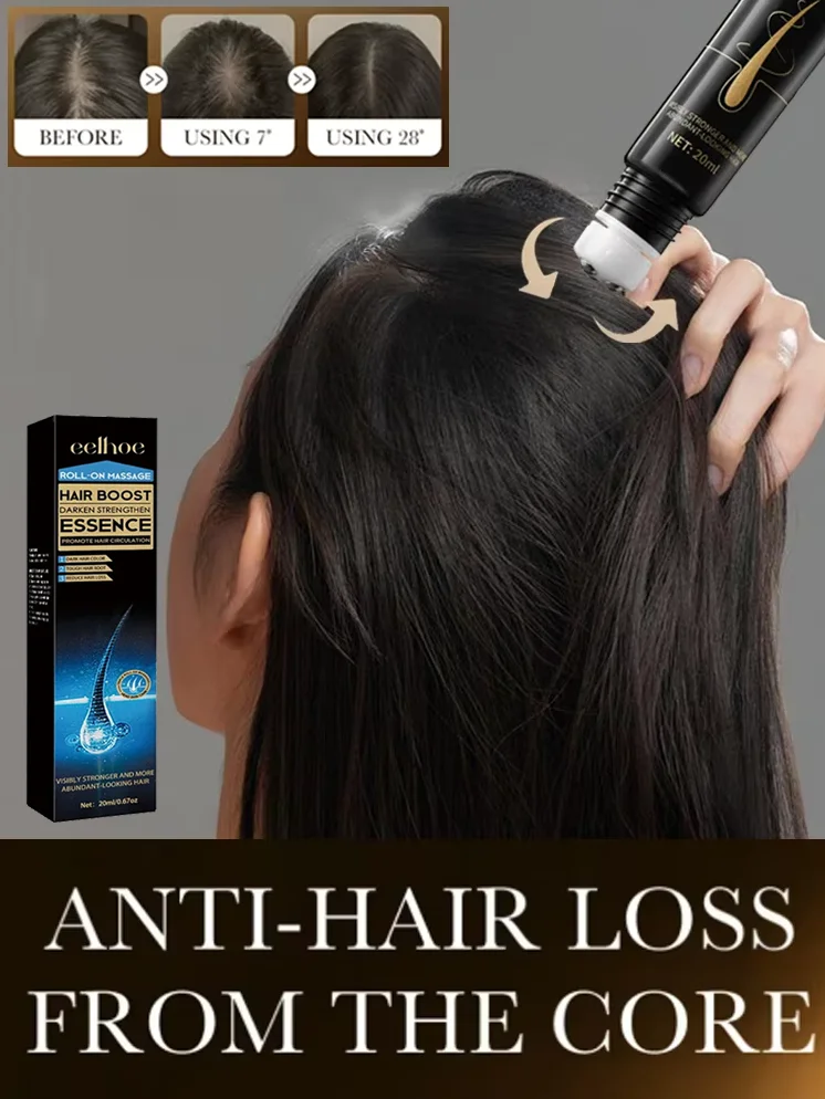 

Hair Loss Scalp Care Serum Hair Growth Enhancer Men Women Ginger Oil Revitalizing