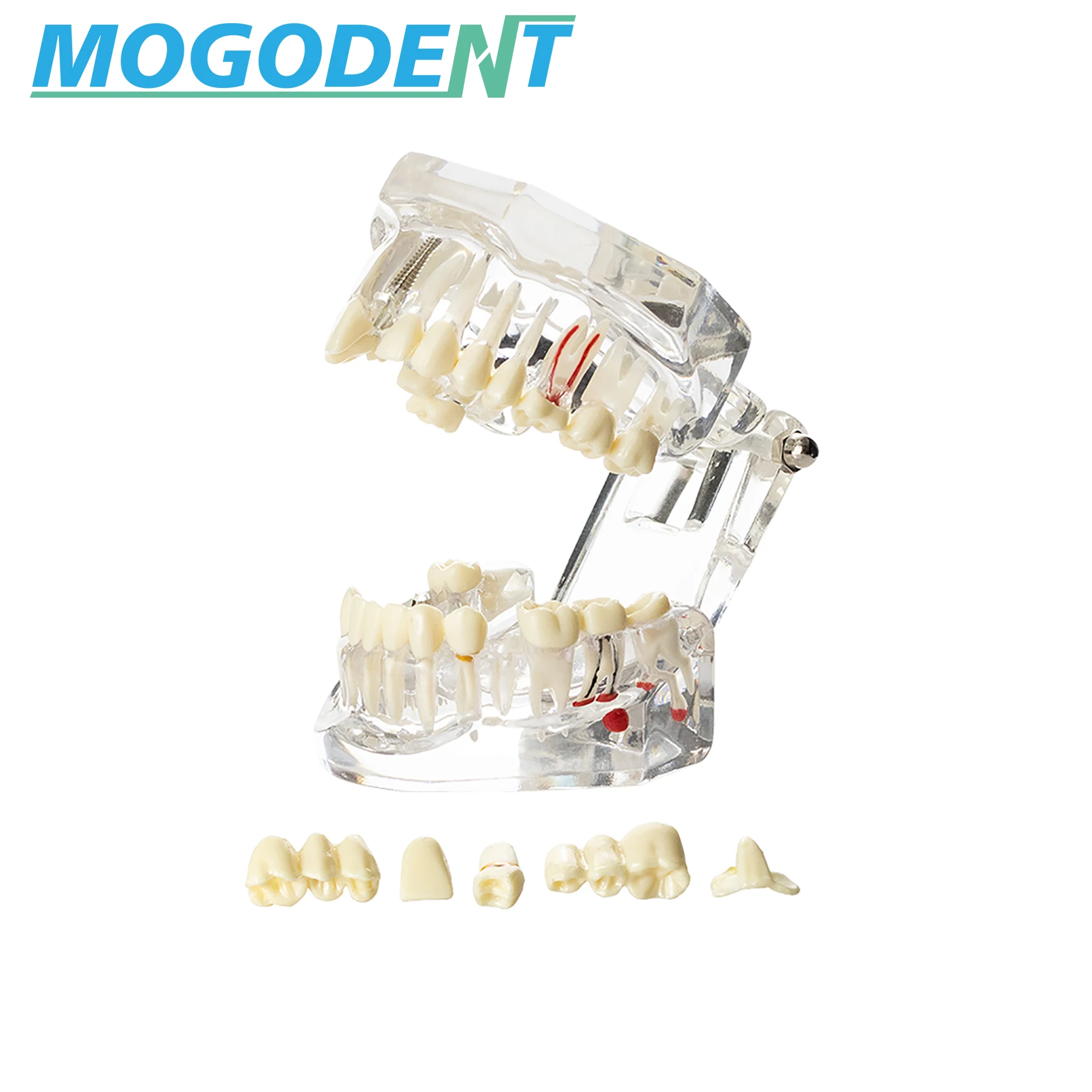 Thumbnail 3 - #63 Dental Teaching Models List of Top Picks