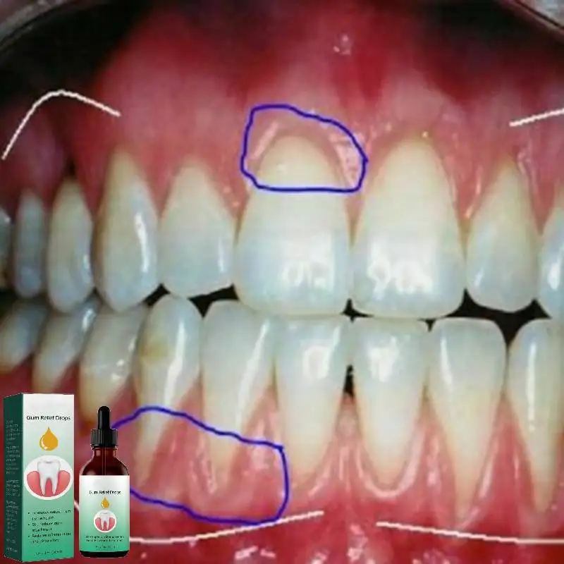 Suero amarillo para reparación de encías, suero para aliviar la hinchazón Gingival, eliminar manchas, cuidado bucal, higiene Periodontal