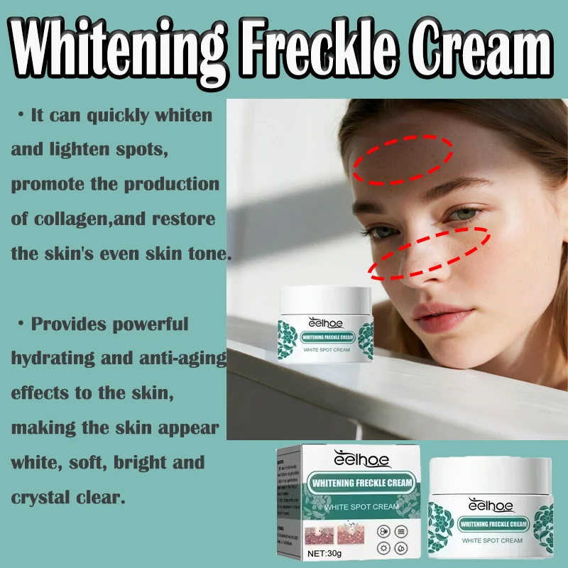 eelhoe Niacinamide Melasma Brightening Cream Reduce Melanin Brighten Lighten Dark Skin Chloasma Fades Stubborn Discoloration