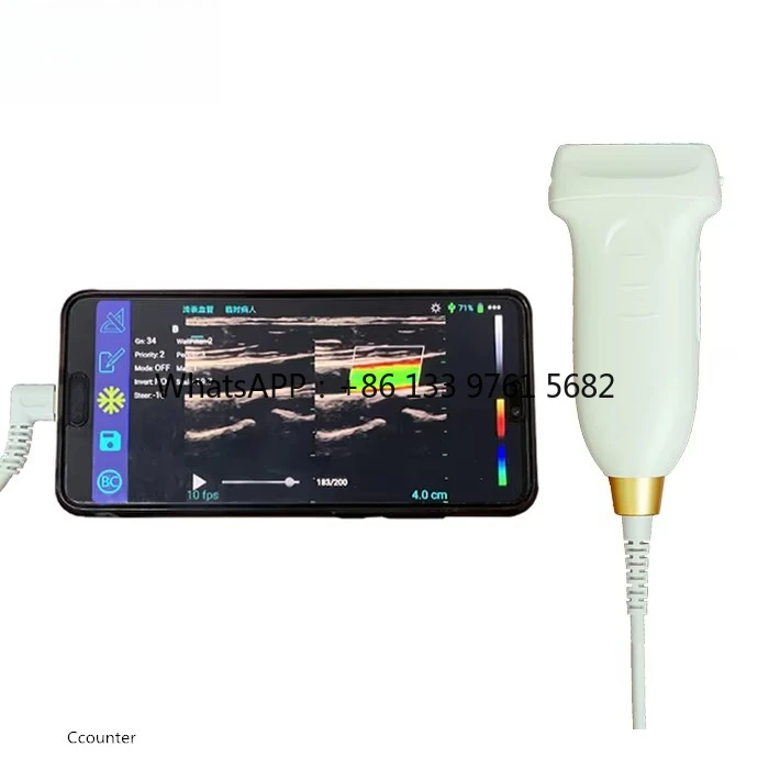 SUN-D2 128-элементный USB-ультразвуковой зонд-планшет